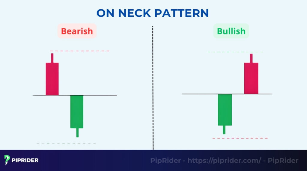 What Is the On-Neck Pattern?